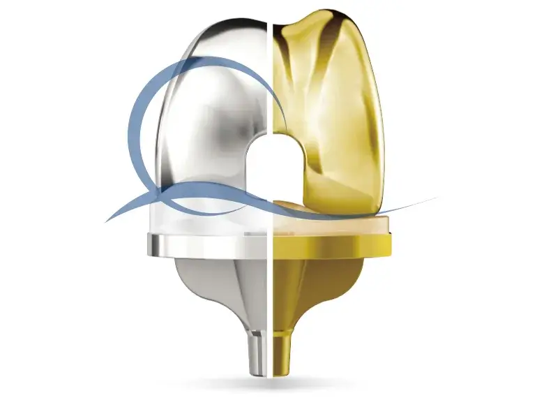 Medacta GMK Sphere — оригінальне зображення Medacta