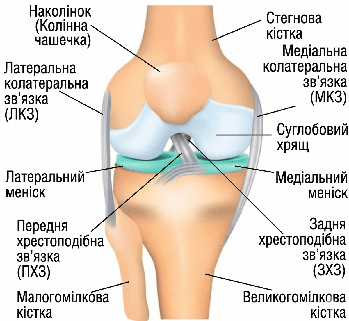 МРТ та підходи до оцінки меніска